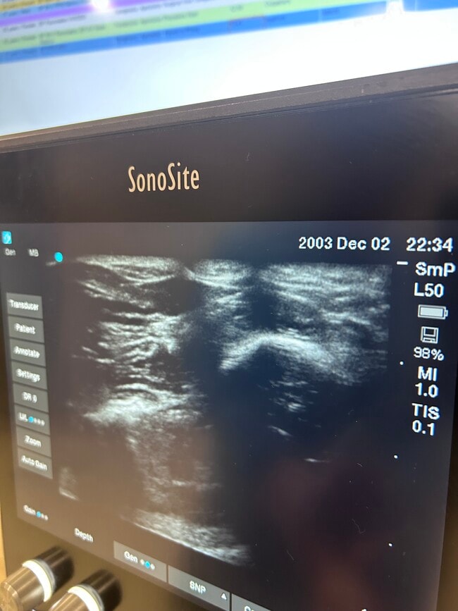 Photo - 15101 Callohan Ct Townhome